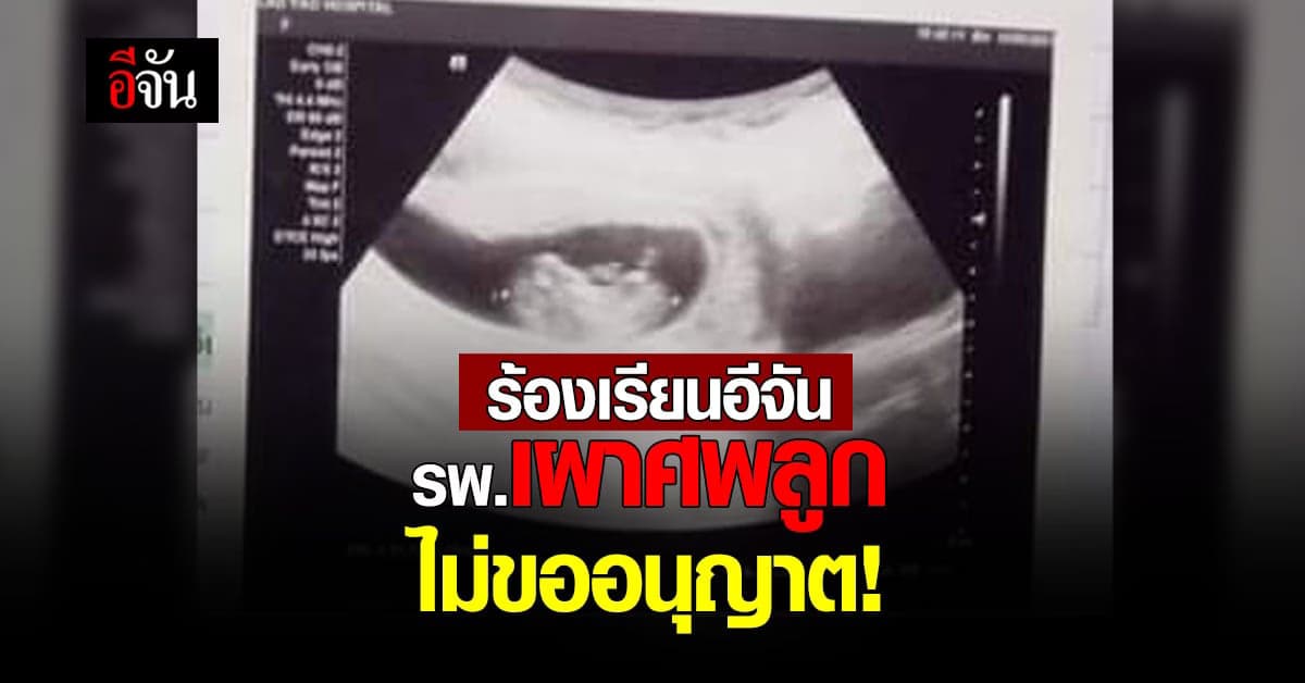ร้องอีจัน! ฝากศพลูกไว้กับ รพ. ไม่ทันมารับ รพ.เผาศพแล้ว!