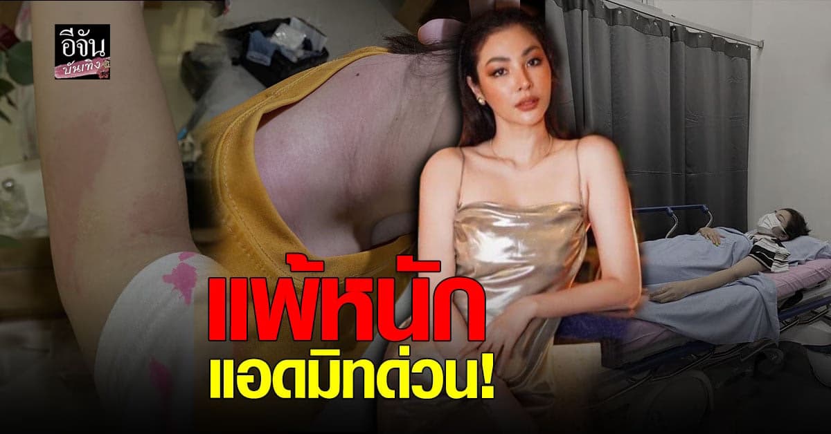 ฝ้าย สุภาพร แอดมิท ด่วน หลังแพ้ บาธบอม ของโรงงแรม