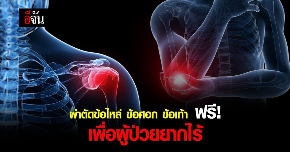 วชิรพยาบาล ผ่าตัดไหล่ ศอก ข้อเท้าเทียม เพื่อผู้ป่วยยากไร้ ฟรี!