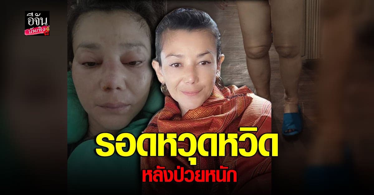 เอ๋ อัจฉรา เผยรอดชีวิตหวุดหวิด หลังอาการป่วยโรค SLE กำเริบ