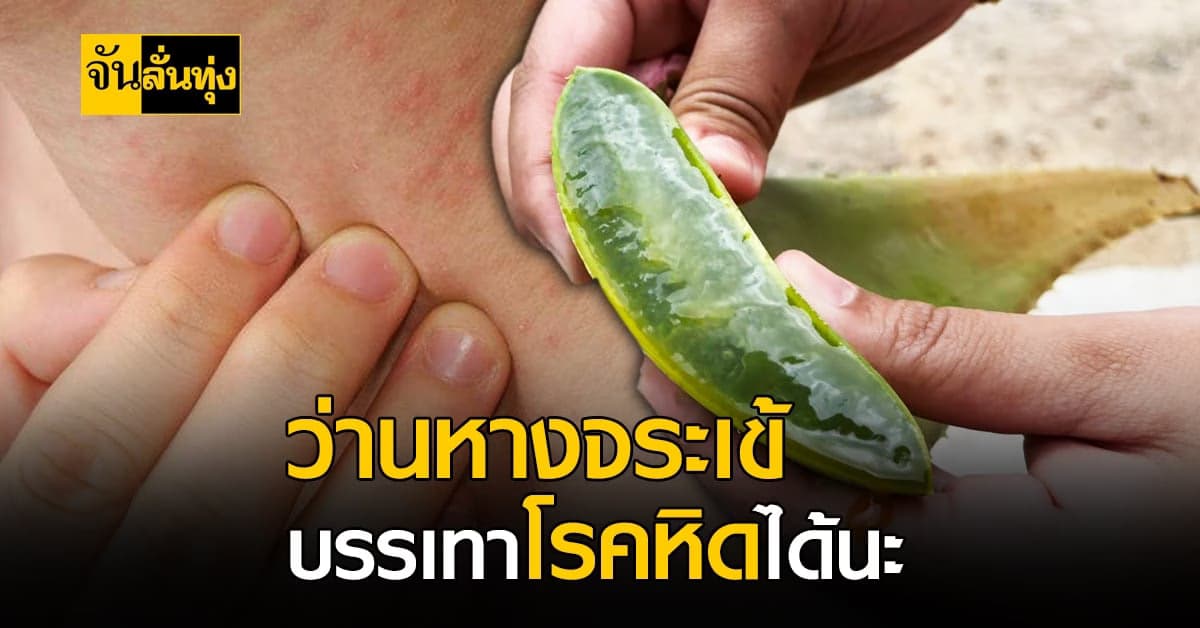 ประโยชน์ของว่านหางจระเข้ ช่วยรักษาโรคหิด