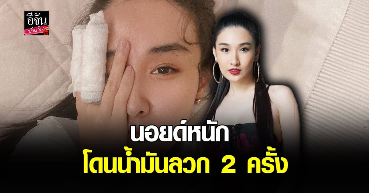 กระติ๊บ​ เล่าเหตุการณ์โดน น้ำมันลวก​ พร้อมเปิดใจเรื่อง ความรัก​ 10​ ปี