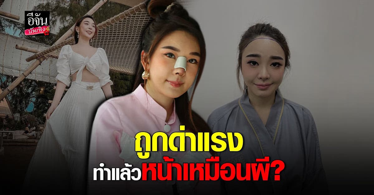 หญิงแย้ นนทพร เปิดใจเรื่อง ศัลยกรรม รับเคยถูกด่าแรง จนชิน