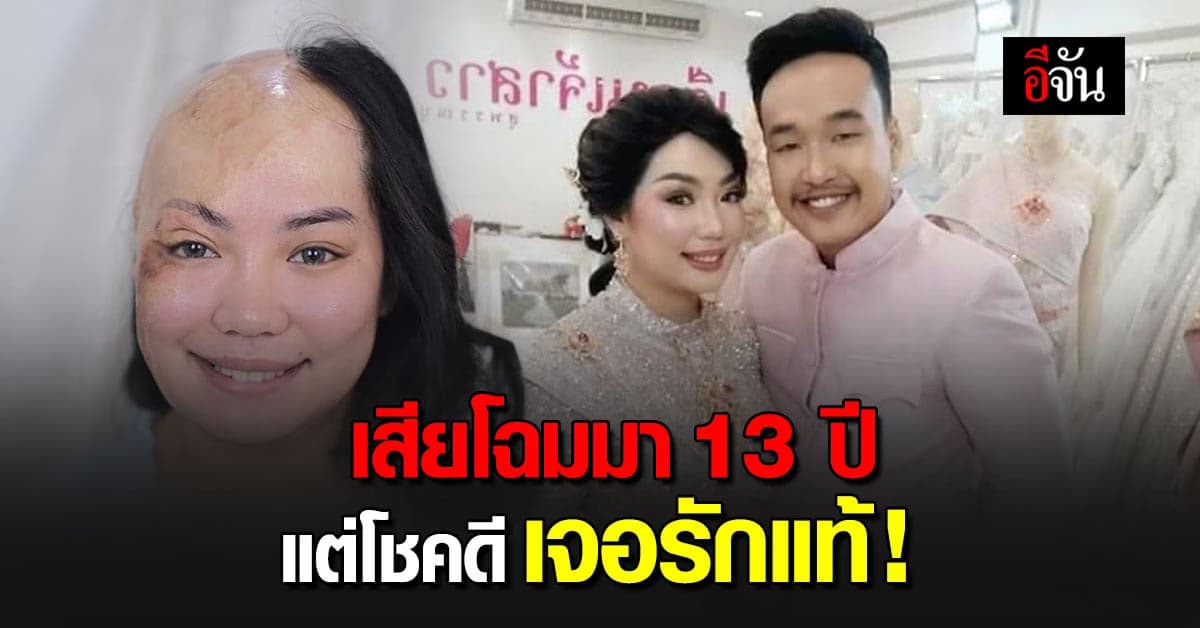 make up เติมฝัน เปิดใจ สาวเสียโฉม 13 ปี แต่โชคดี ได้เจอรักแท้ !