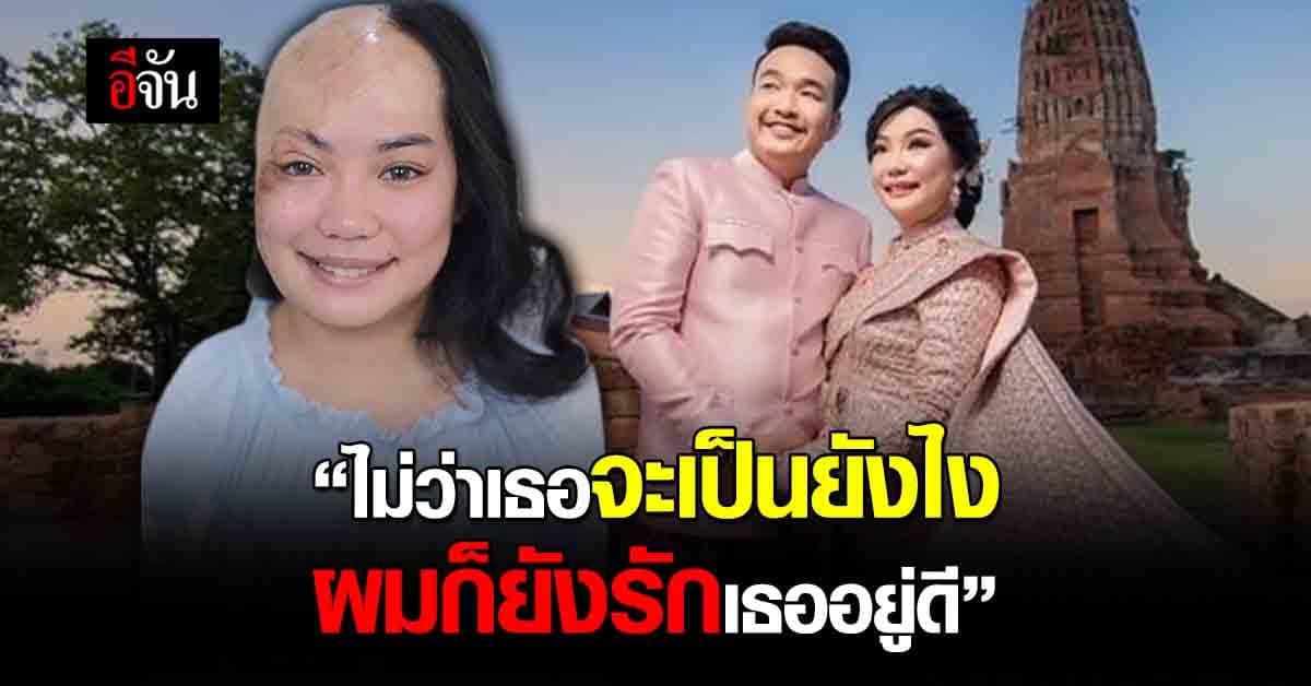 4 ปี พิสูจน์รักแท้ เปิดเส้นทางรัก เจ้าสาวเสียโฉม กับ เจ้าบ่าว