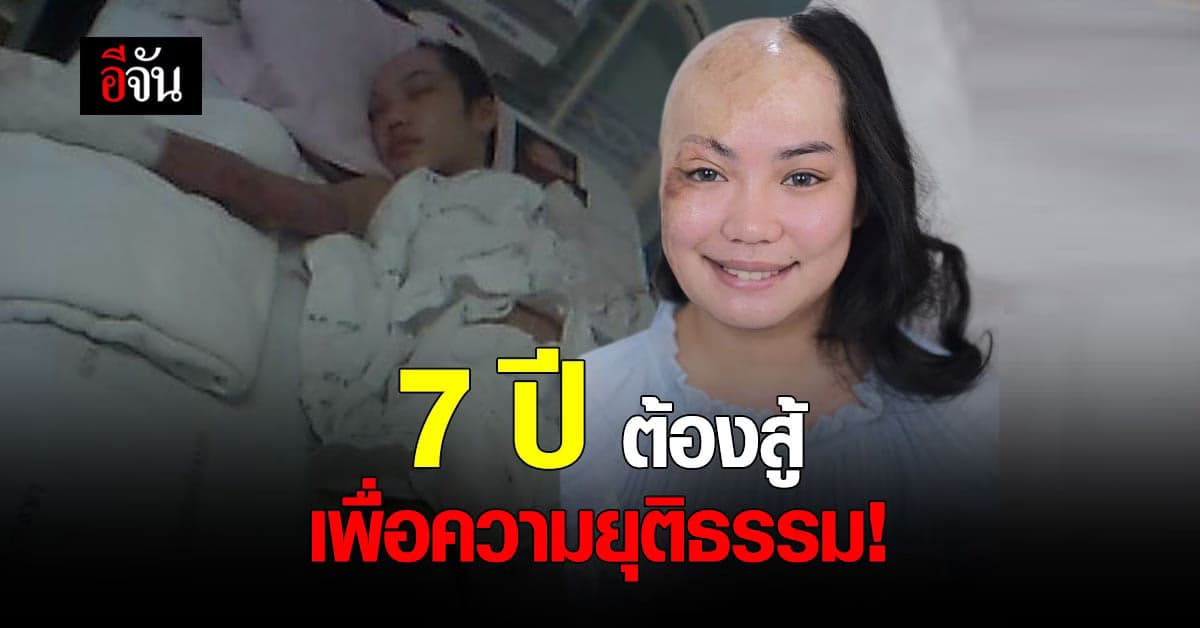 เปิดใจ เจ้าสาวเสียโฉม สู้คดี 7 ปี  รถสิบล้อพุ่งชน เผาเธอทั้งเป็น