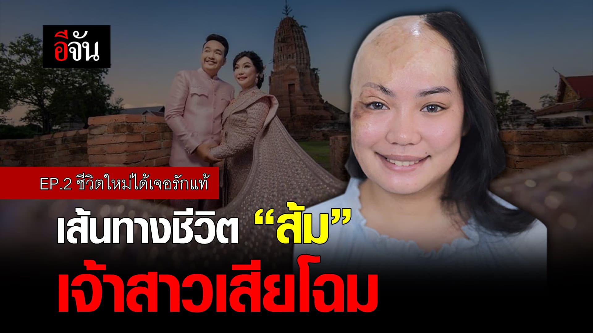 คลิป : เส้นทางชีวิต “ส้ม” เจ้าสาวเสียโฉม EP.2 ชีวิตใหม่ได้เจอรักแท้