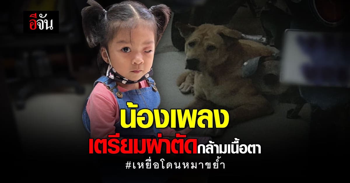 อัปเดต น้องเพลง เหยื่อโดนหมาขย้ำ เตรียมผ่าตัด กล้ามเนื้อตา