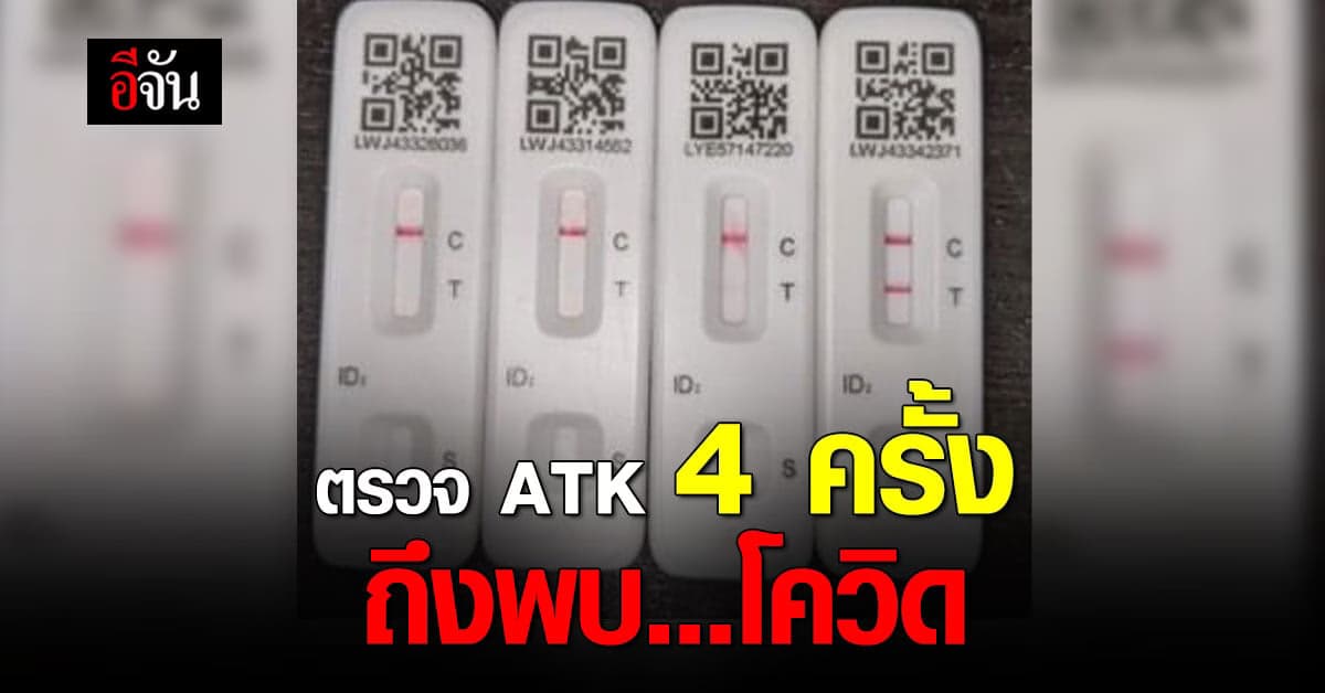 ดร.อนันต์ เตือน ประชาชน หมั่นตรวจ ATK หาเชื้อ โควิด ก่อนสาย!