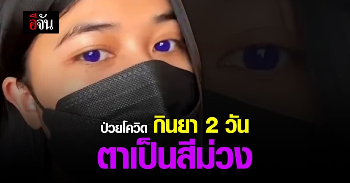 สาวป่วยโควิด กินยาฟาวิพิราเวียร์ 2 วัน ดวงตาเป็นสีม่วง!