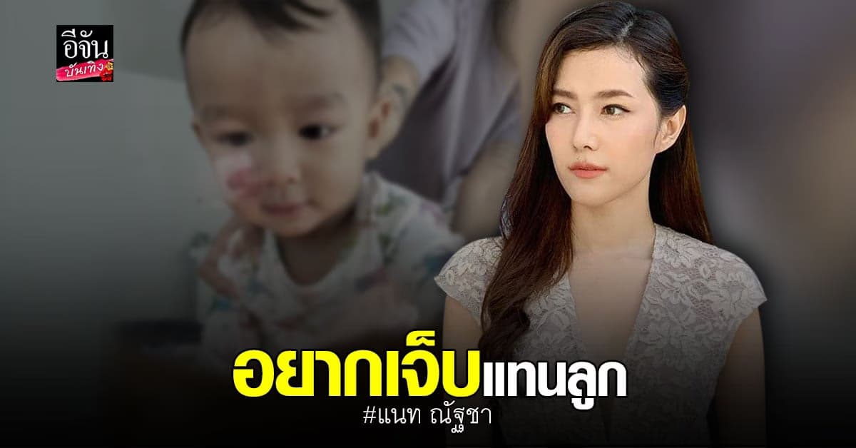 แนท ณัฐชา ช็อก! หมากัดหน้าลูกชาย ต้องหามส่ง รพ. ด่วน