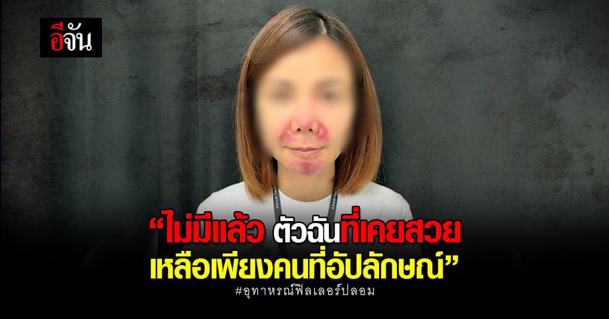 สาวโพสต์เฟซบุ๊ก หลังเจอพิษ ฟิลเลอร์ปลอม จาก คลินิคศัลยกรรม