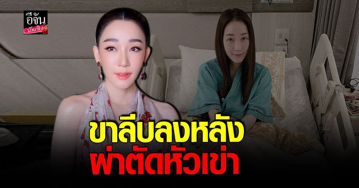 ตู่​ ปิยวดี​ เผยภาพขาขวาลีบ​หลังจาก​ผ่าตัดหัวเข่า​