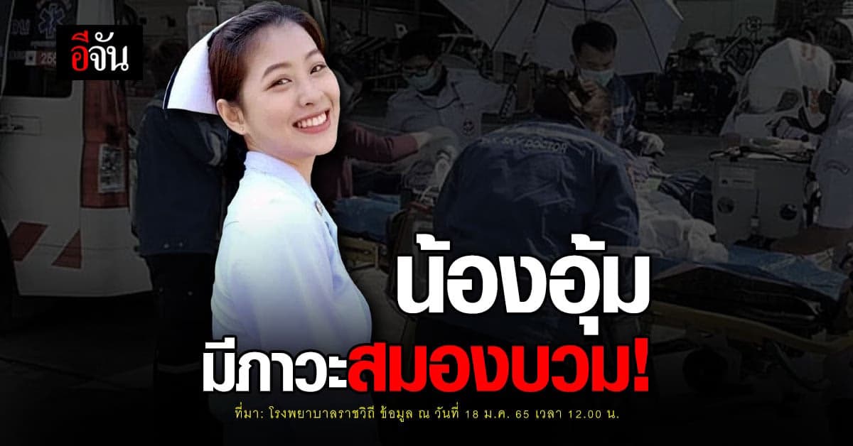 โรงพยาบาลราชวิถี พบ น้องอุ้ม อยู่ในภาวะสมองบวม ล่าสุด ยังไม่รู้สึกตัว!