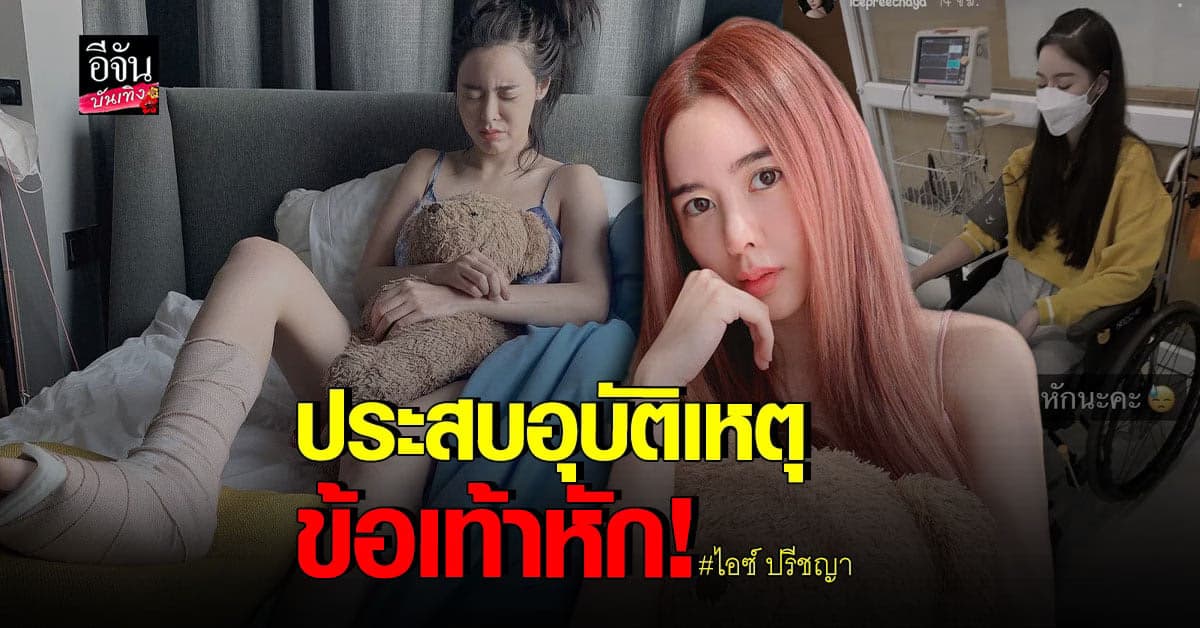 ไอซ์ ปรีชญา ประสบอุบัติเหตุ กลางกอง จนข้อเท้าหัก