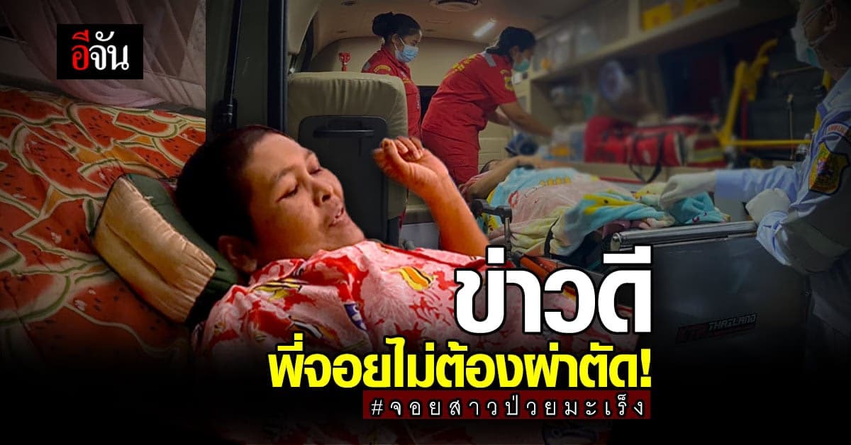 จอยสาวป่วยมะเร็ง หมอแนะ ฉายแสง ไม่ต้องผ่าตัด