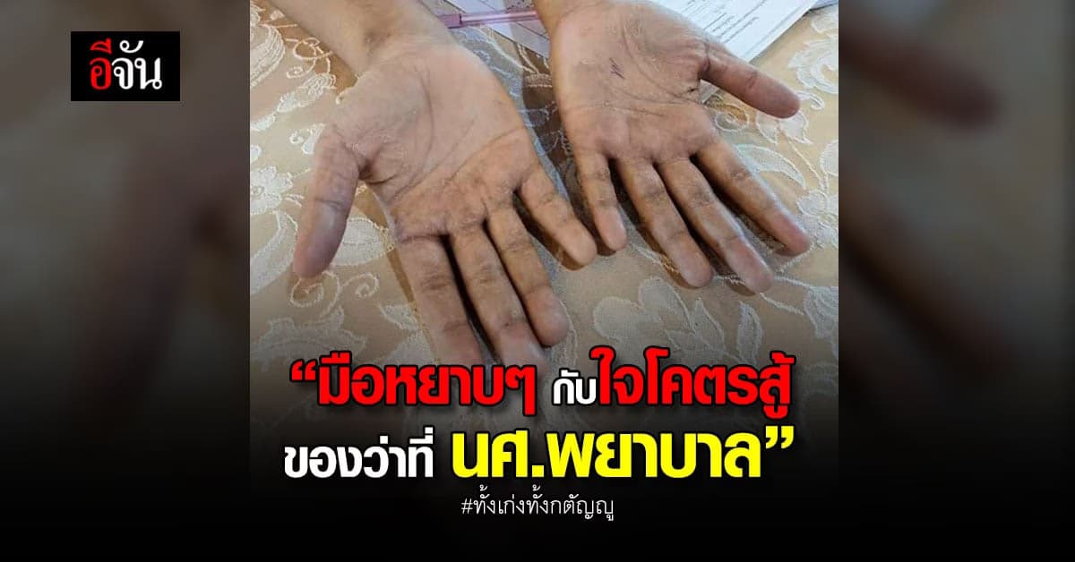 อาจารย์เล่าความประทับใจ ว่าที่นิสิตพยาบาล สอบสัมภาษณ์ สะดุดตาที่มือ
