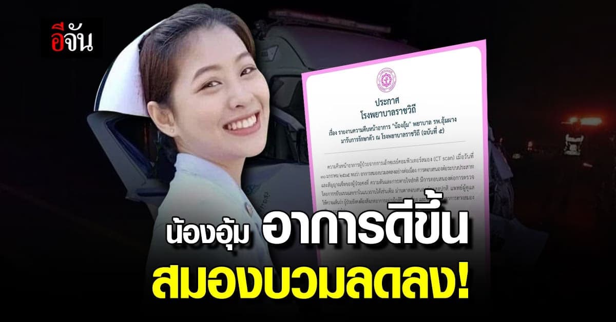 รพ.ราชวิถี อัปเดตอาการน้องอุ้ม อาการสมองบวมลดลง ตอบสนองคงที่