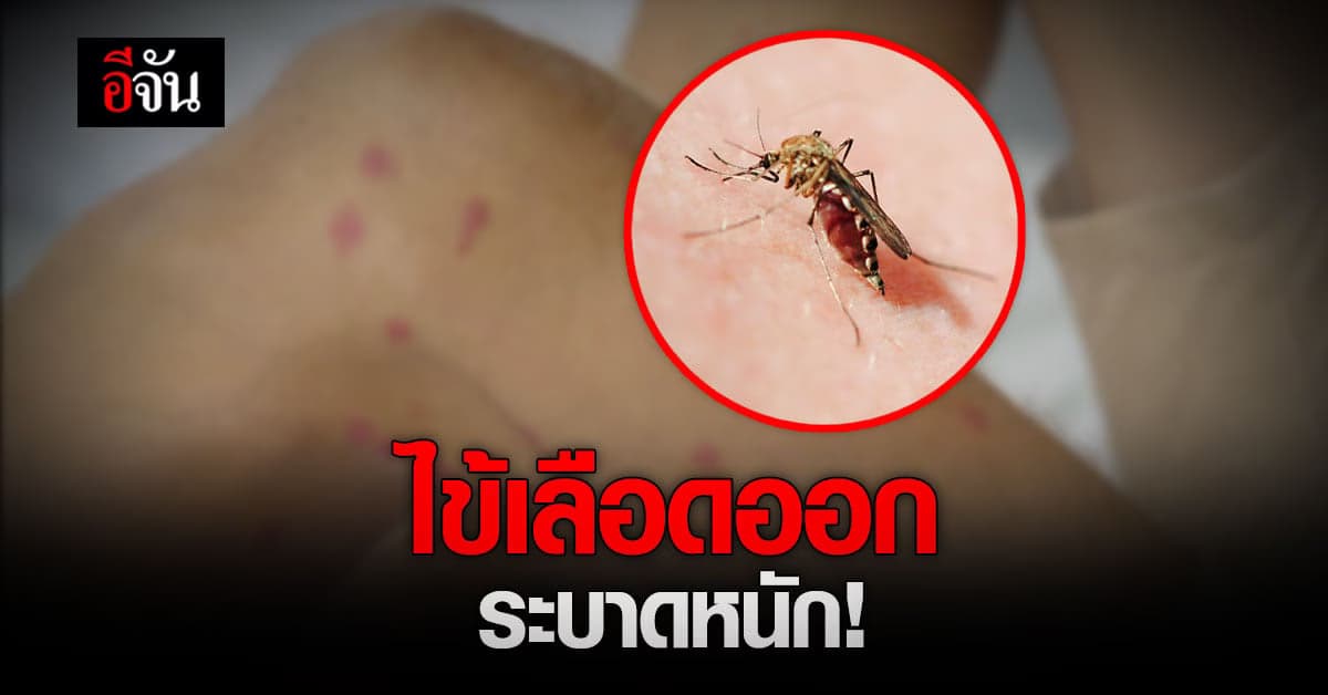 กรมควบคุมโรค เตือน ระวังโรคไข้เลือดออก คาด ปีนี้ระบาดหนัก