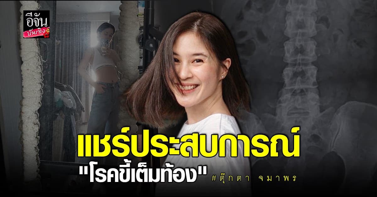 ตุ๊กตา จมาพร ป่วยเป็นโรคขี้เต็มท้อง พร้อมเผยข้อมูลเป็นวิทยาทาน