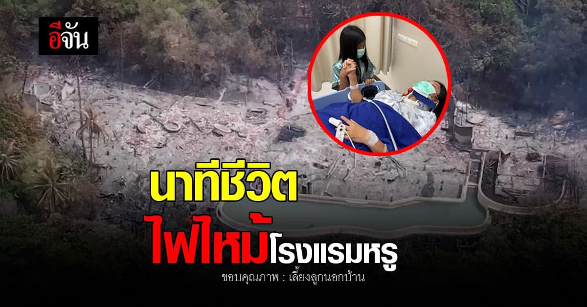 นาทีชีวิต! หมอโอ๋ เล่า ไฟไหม้หนัก ขณะหลับ โชคดีมีสติตั้งตัวทัน