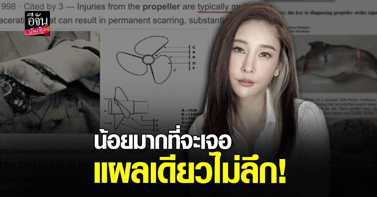 พ่อนิ้ง โศภิดา วิเคราะห์แผลที่ขา แตงโม