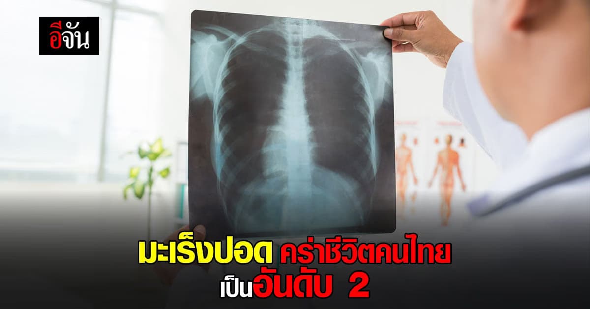 มะเร็งปอด เป็นสาเหตุของการเสียชีวิต อันดับ 2 ของคนไทย