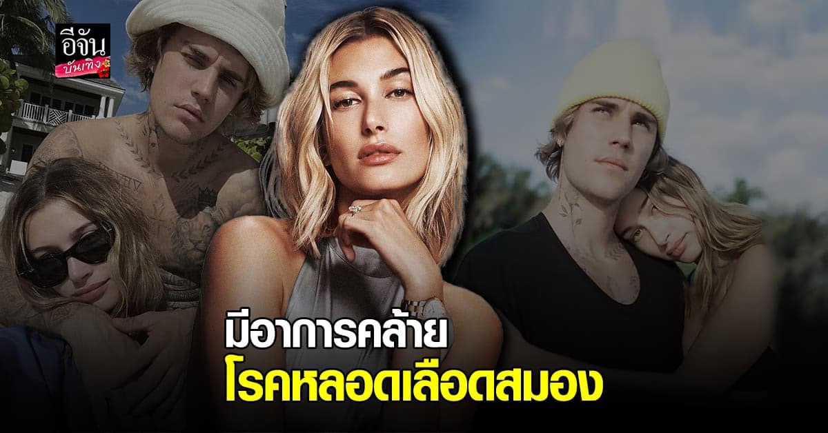 สุดช็อกหลัง ​เฮลีย์​ บีเบอร์​ เผยตรวจพบ​ ลิ่มเลือดอุดตันในสมอง​