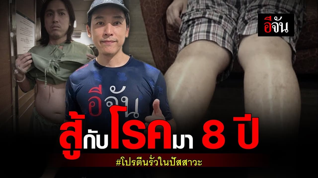🎬 สู้กับโรคมา 8 ปี โปรตีนรั่วในปัสสาวะ