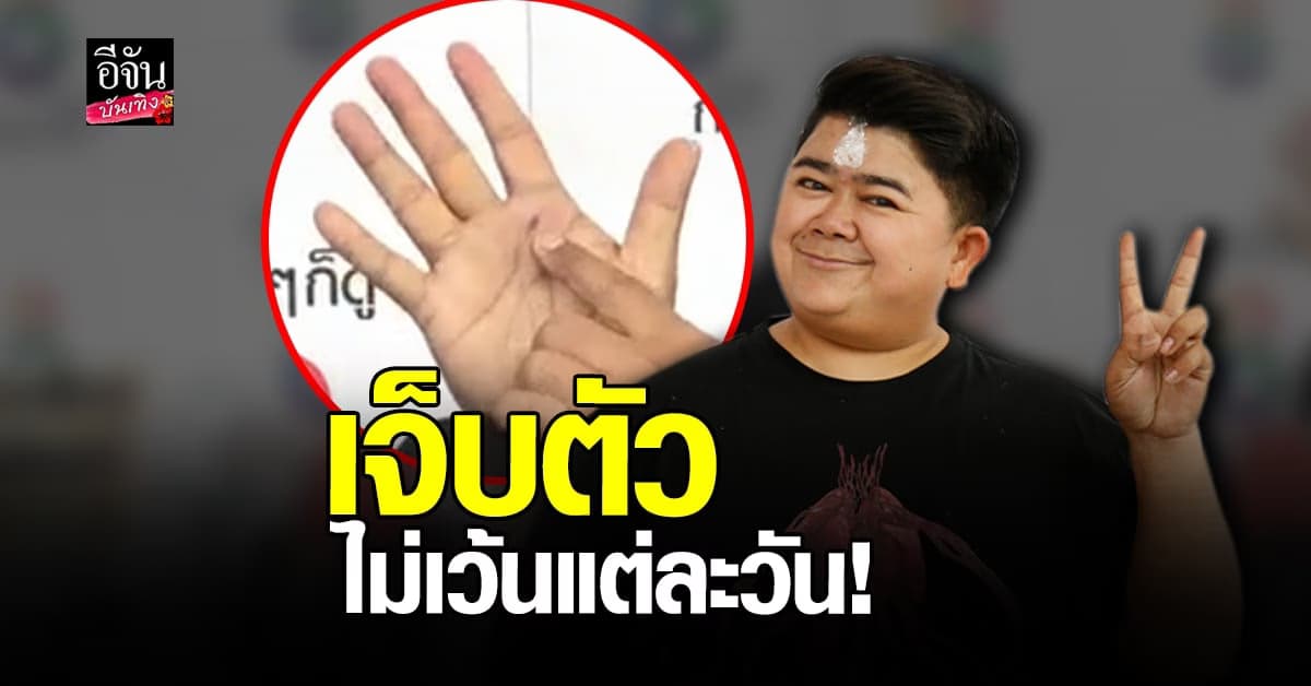 ชงหนักมาก​ โก๊ะตี๋​ อารามบอย​ เล่าเหตุการณ์​เจ็บตัว​ตั้งแต่ต้นปี