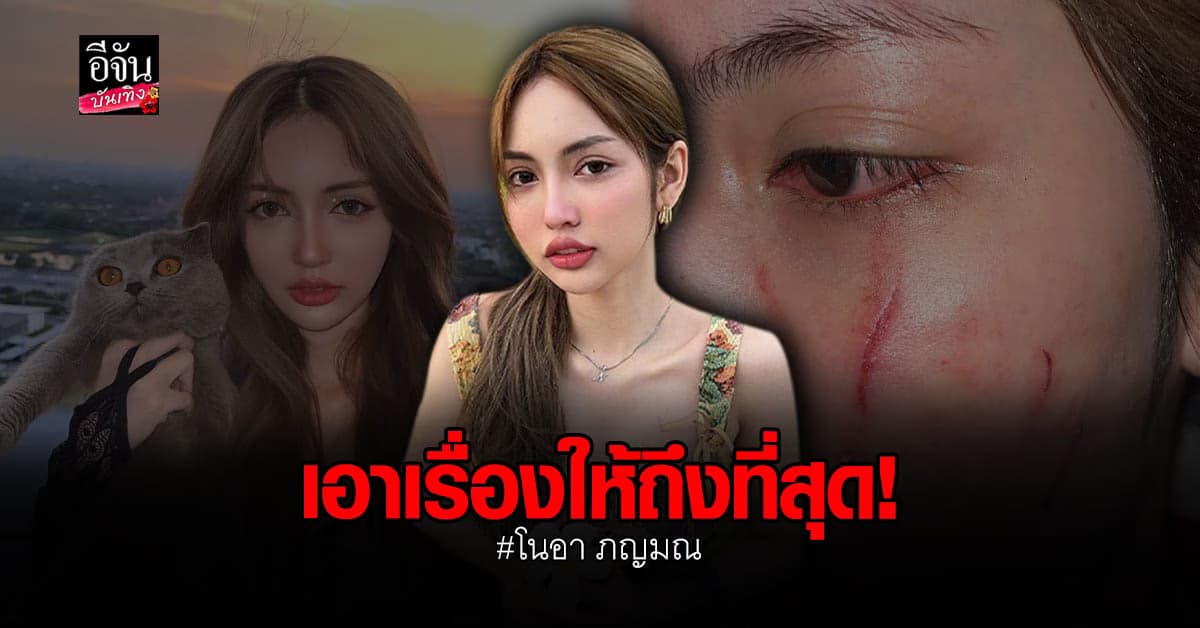 โนอา ภญมณ พร้อม ผู้จัดการ เข้าแจ้งความ ปมถูกทำร้ายร่างกาย