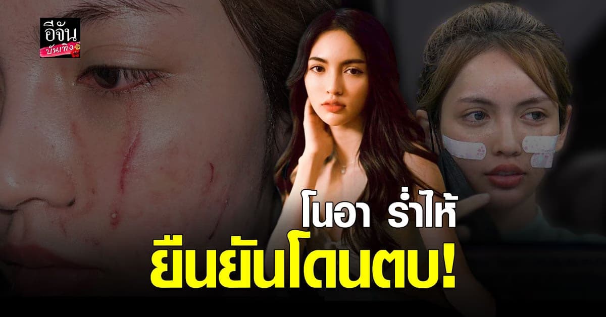 โนอา​ ยันโดน​ รุมตบ​ และทำ​ อนาจาร​ จริง​ พร้อมแจงปมชี้หน้าด่าคู่กรณี