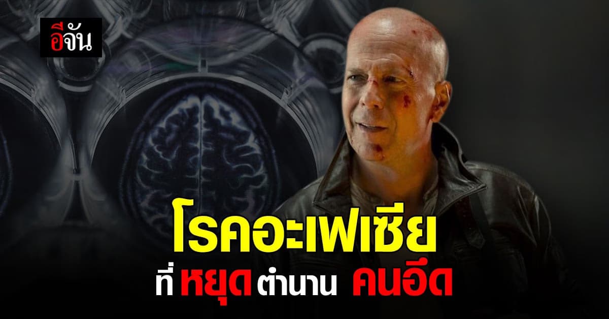 ภาวะเสียการสื่อความ Aphasia ที่ทำให้ต้องหยุด ตำนาน ” คนอึด ”