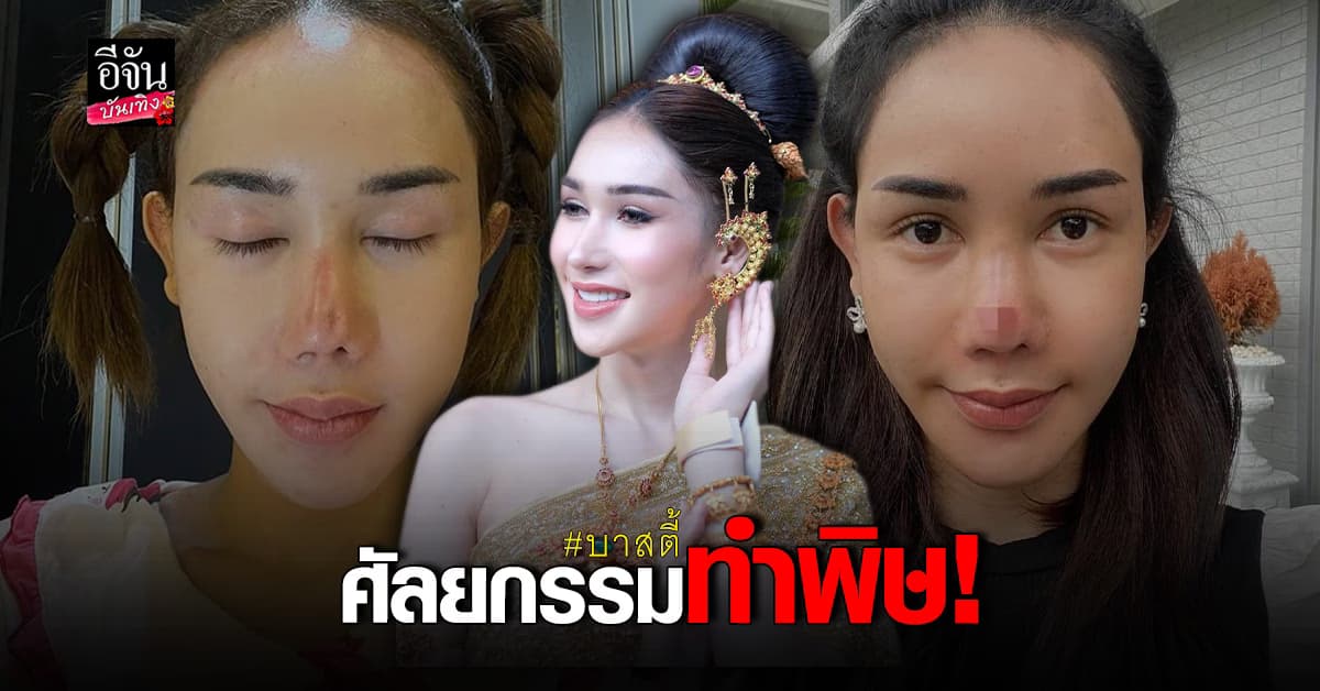 ทรมานมาก บาสตี้ เจอพิษศัลยกรรม ทำจมูกพัง ติดเชื้อ
