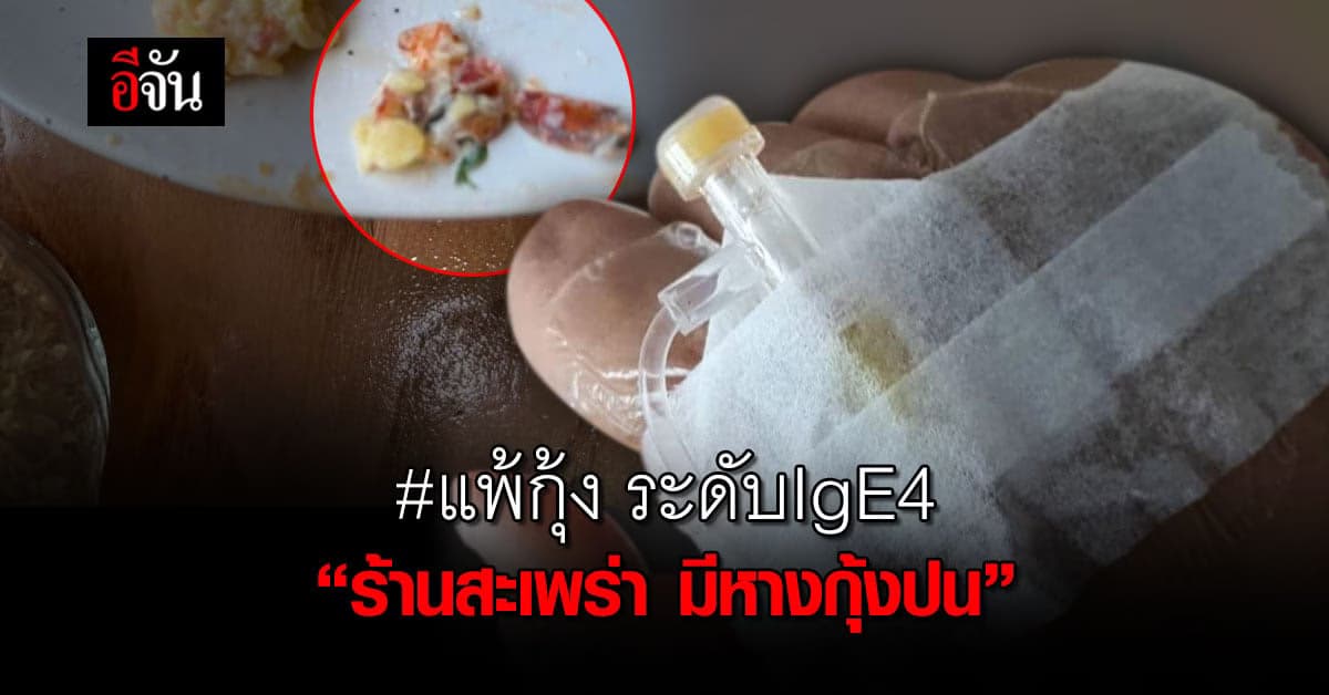 สาวแชร์ประสบการณ์ แพ้กุ้งระดับlgE 4 รุนแรงถึงชีวิต!