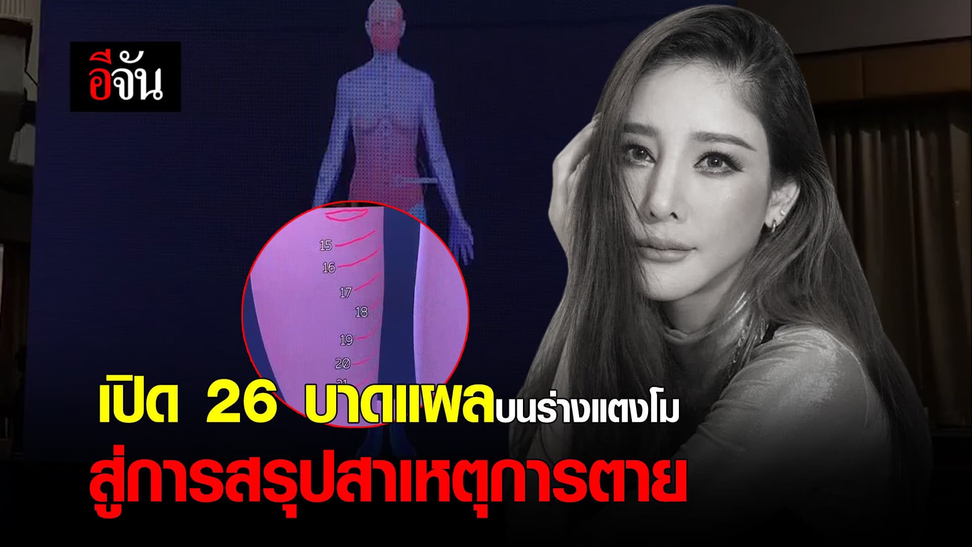 🎬 เปิด 26 บาดแผลบนร่างแตงโม สู่การสรุปสาเหตุการตาย
