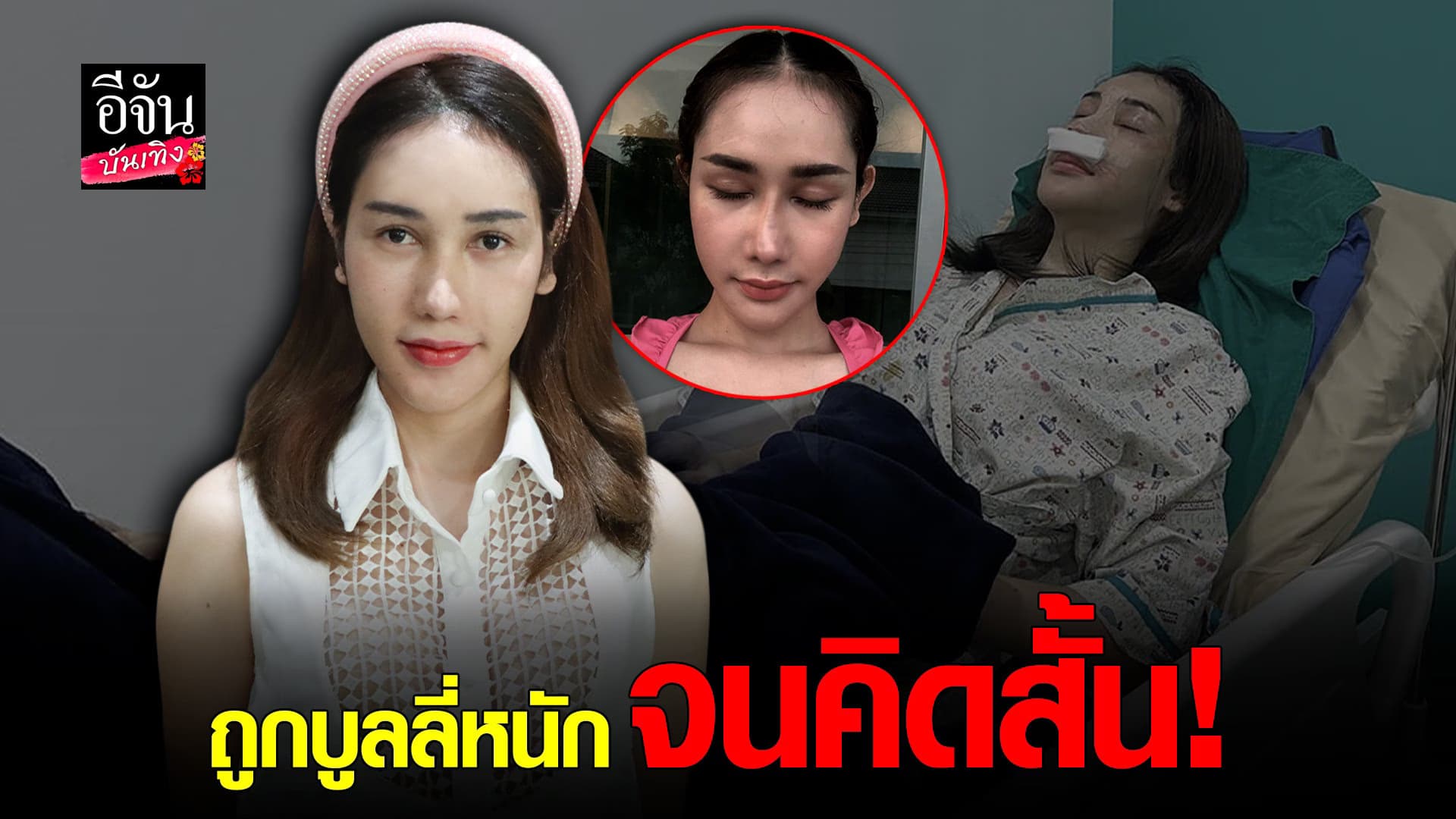 🎬คลิปบันเทิง : บาสตี้ ฐิติกร รับคิดผิดตัดสินใจแก้จมูกตามเทรนด์