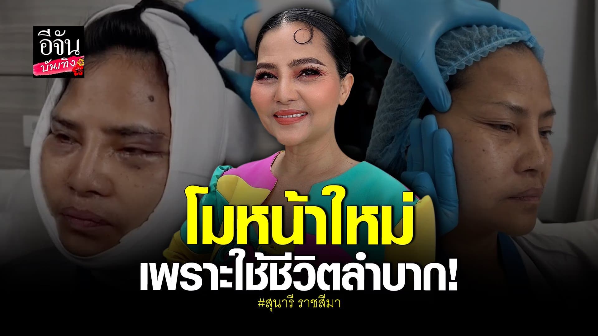 🎬 คลิปบันเทิง : สุนารี ราชสีมา โมหน้าใหม่ เพราะปัญหาการใช้ชีวิต วัย54