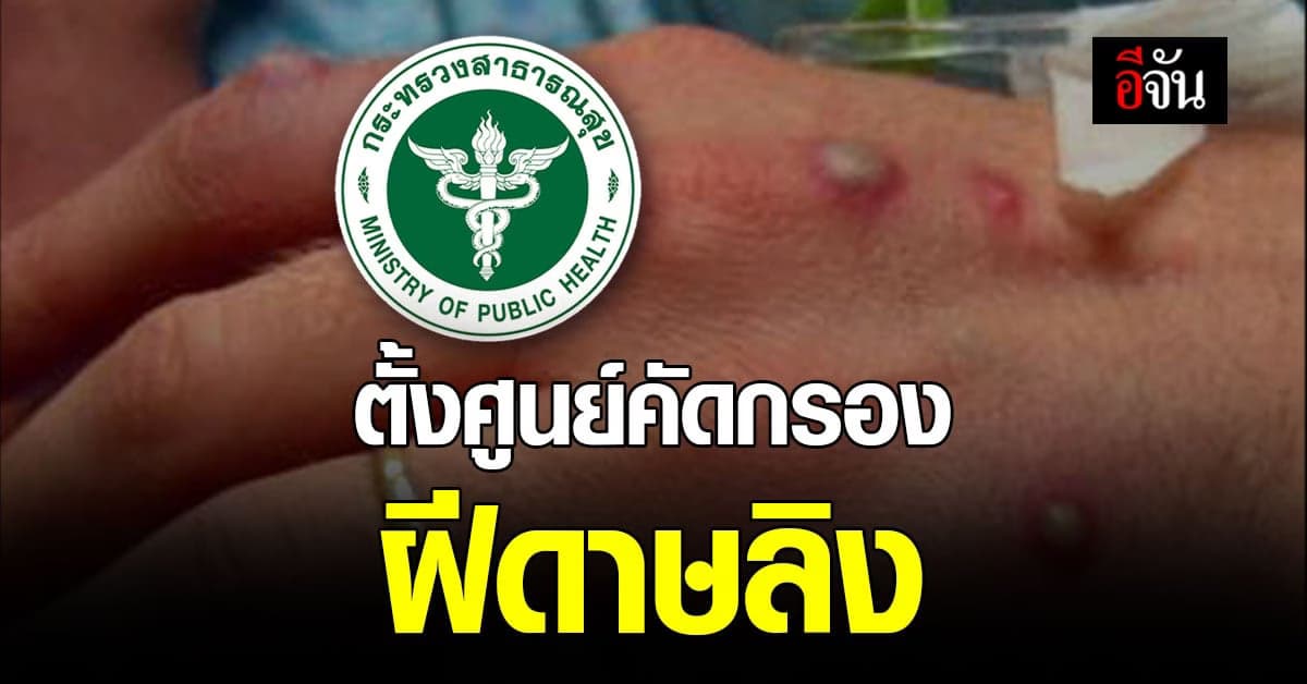 กรมควบคุมโรค ตั้งศูนย์คัดกรอง โรคฝีดาษลิง ผู้เดินทางจาก ประเทศที่ระบาด