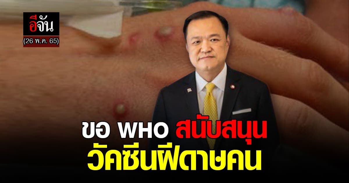 อนุทิน หารือ ผอ.ใหญ่ WHO ขอสนับสนุน วัคซีน เตรียมไว้หาก ฝีดาษลิง ระบาด
