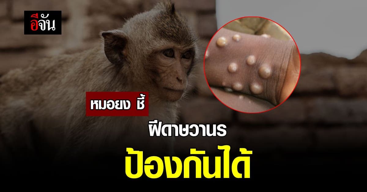 หมอยง เผยโรคฝีดาษวานร คล้ายไข้ทรพิษ ชี้ ป้องกันได้