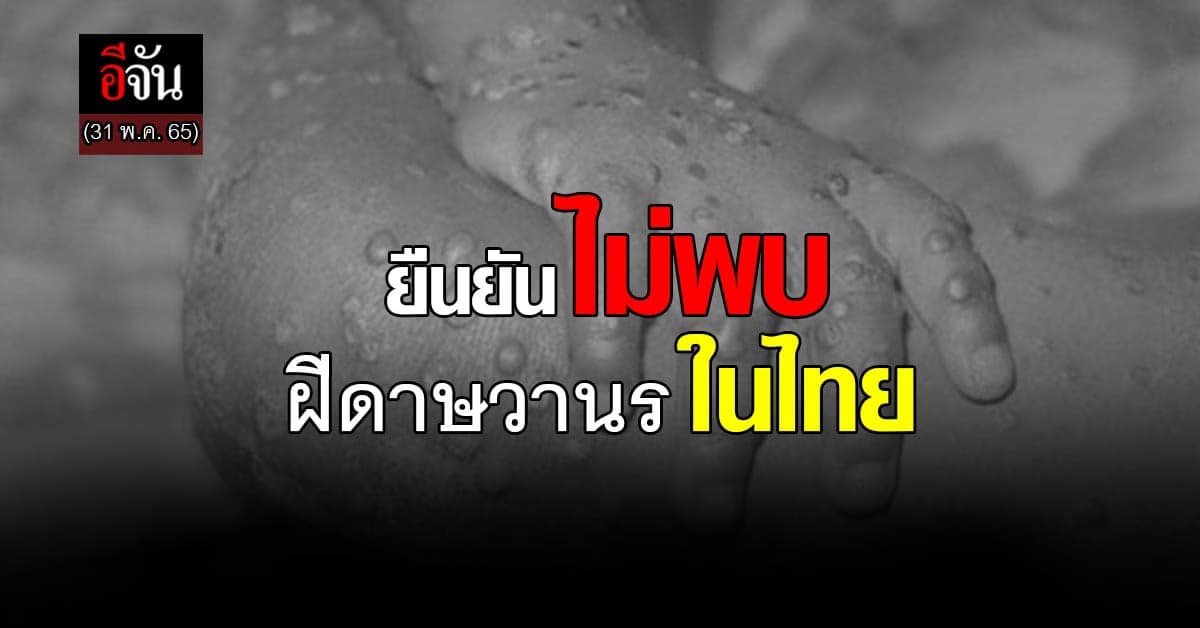รัฐบาล ขอประชาชนมั่นใจ สธ. ยืนยันไม่พบ ฝีดาษวานรในไทย