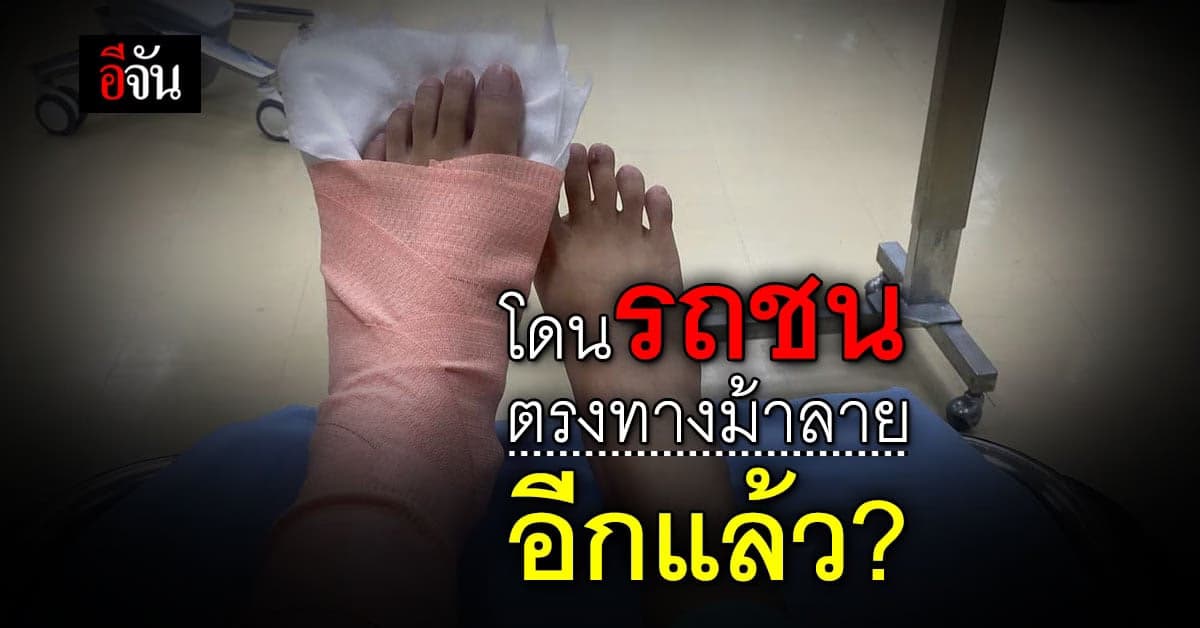 สาวโพสต์ โดนรถชน ทางม้าลาย กระดูกเท้าแตก แต่คนชนหาย!