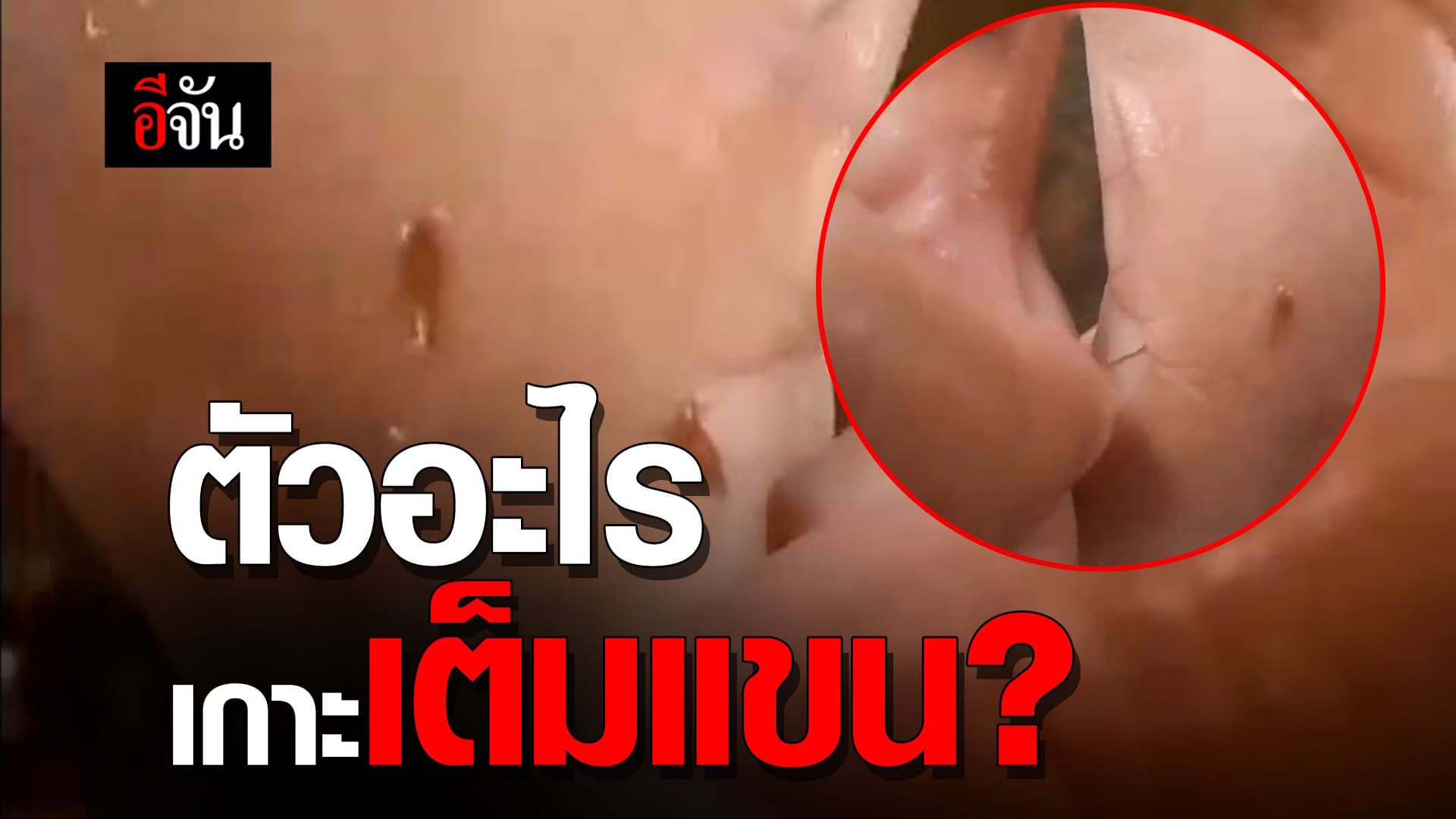 ตัวอะไรเกาะเต็มแขน?