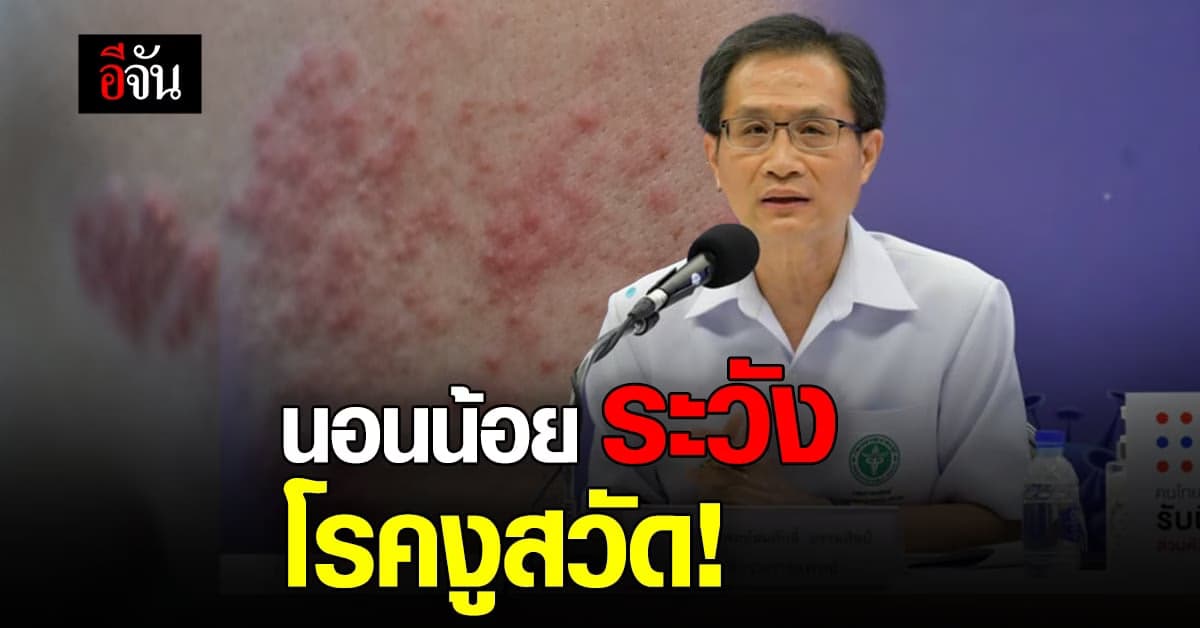 กรมการแพทย์ โดย สถาบันโรคผิวหนัง เตือน นอนน้อย เสี่ยง งูสวัด