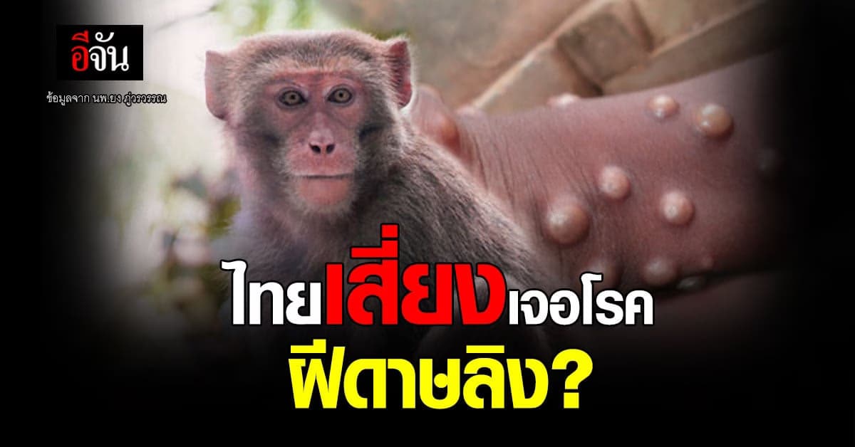 หมอยง ชี้ไทยเสี่ยงเจอโรค ฝีดาษลิง แต่จะระบาดเฉพาะกลุ่ม