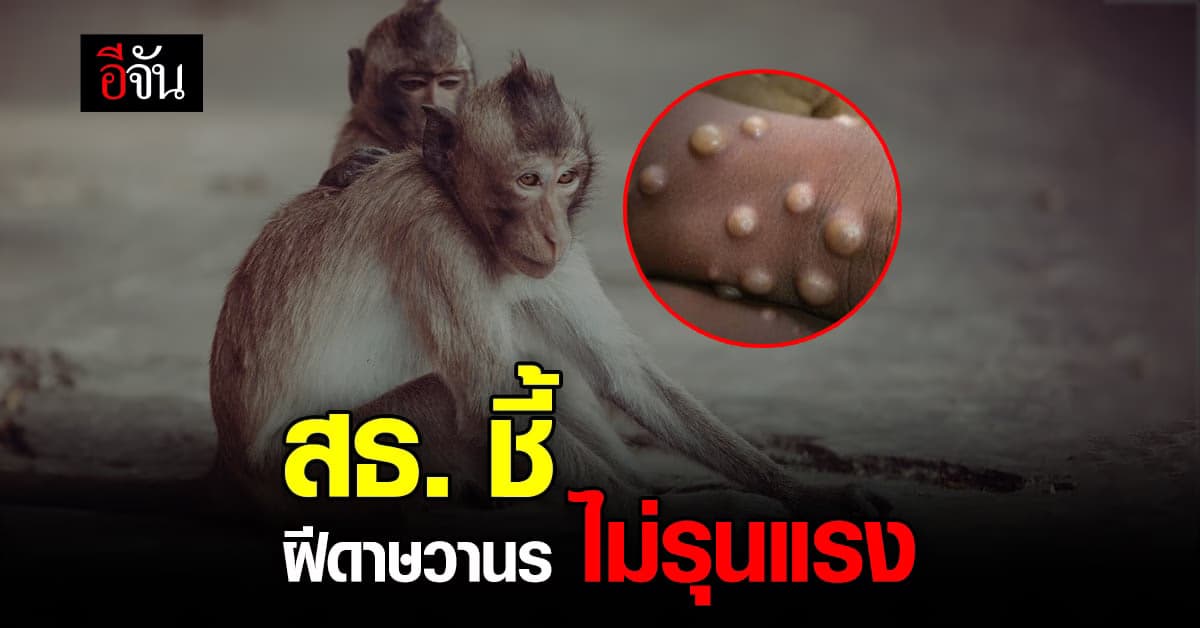 สธ. ยัน ฝีดาษวานร ระบาดไม่เร็ว รุนแรงน้อย เผย WHO ไม่ประกาศภาวะฉุกเฉิน