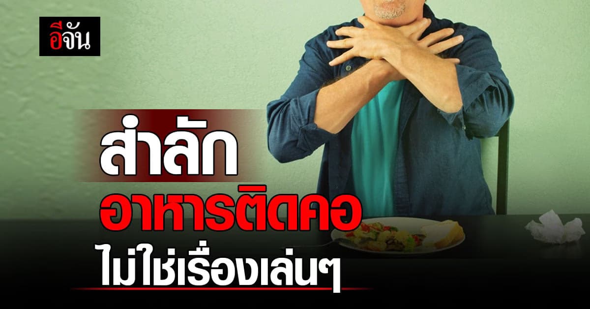 รู้วิธีปฐมพยาบาล เมื่อสำลักอาหารติดคอ ลดเสี่ยงเสียชีวิต
