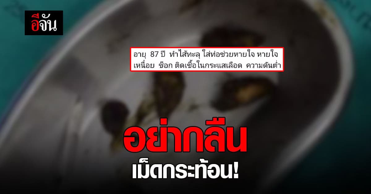 พยาบาลสาว เตือนภัย กลืนเม็ดกระท้อนอันตรายถึงชีวิต