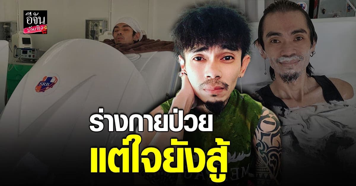 แจ็ค เชิญยิ้ม ป่วยวัณโรคปอด เข้าฟื้นฟู เพิ่มออกซิเจนให้กับร่างกาย